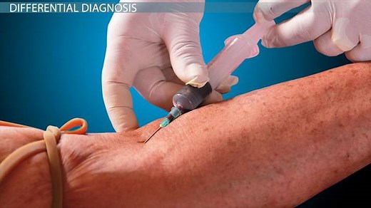 Basic Medical Terms | Acute vs Chronic, Diagnosis & Word Roots