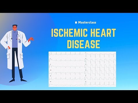 How to Read ECG in Ischemic heart disease