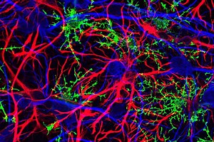 New sequencing technology helps researchers understand brain cell development