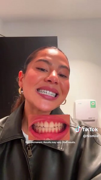 Colour Correcting with Hismile V34: Instant Results