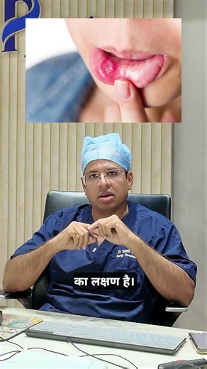Oral Cancer Warning Signs | Cancer Doctor Explains #drsumitshah #prolifecancercentre