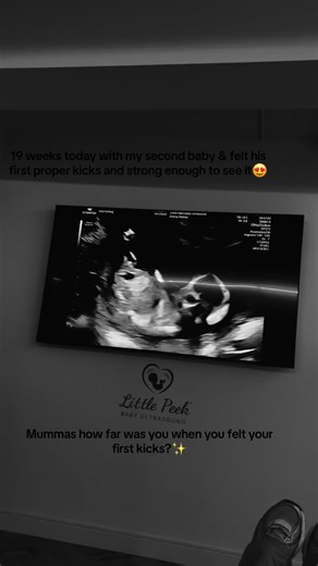 Experiencing First Kicks at 19 Weeks Pregnant