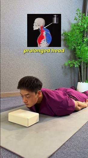 Fix Forward Head Posture & Neck Hump at Home | 4 Simple Daily Exercises for Better Posture #trending