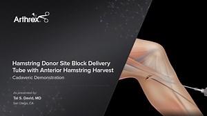 Hamstring Donor Site Delivery Tube with Anterior Hamstring Harvest