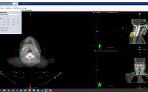Varian Eclipse Image Fusion Basics-bgYR9fI4NCM
