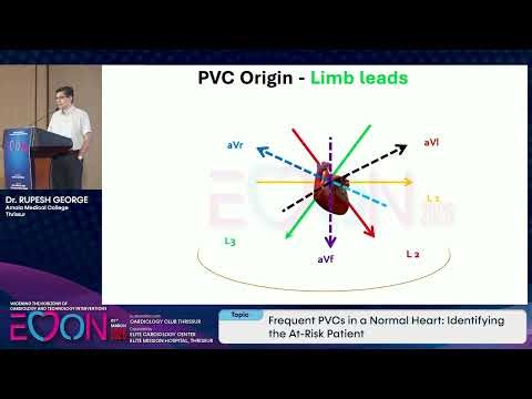 ECCON 2026 | Frequent PVCs in a Normal Heart:Identifying the At Risk Patient |Dr Rupesh | CARDIOLOGY