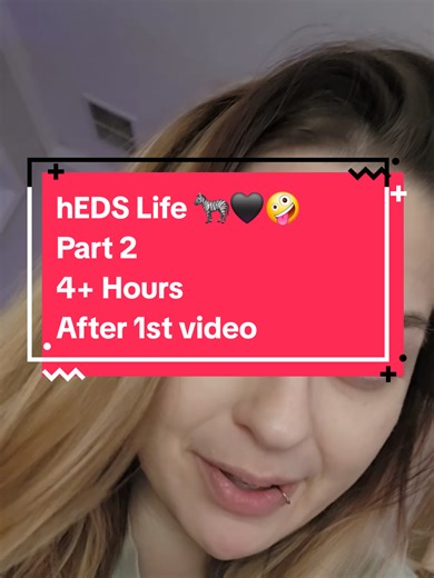 Ehlers-Danlos Syndrome Insights: Life After Diagnosis