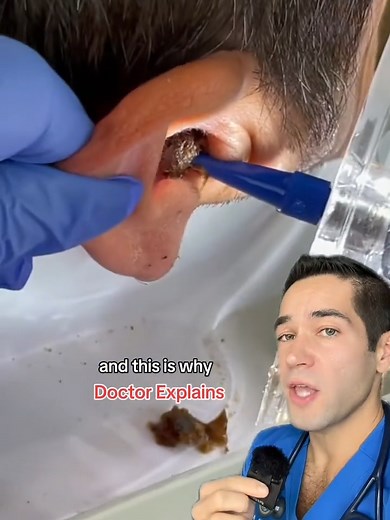 Don't Use Q Tips for Ear Cleaning!