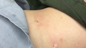 304K views · 1.8K reactions | Dr Sandra Lee aka drpimplepopper on Reels | Facebook