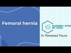 Femoral Hernia