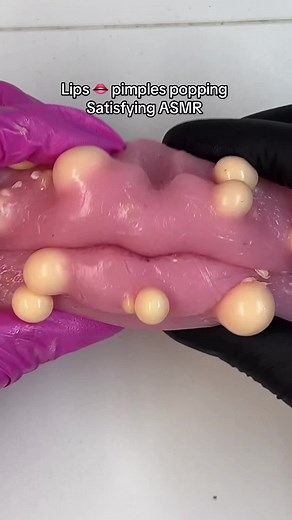 Best Lips Popping ASMR Sounds for Relaxation