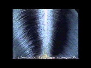 Head and Shoulders Anti Dandruff Shampoo Commercial 2002