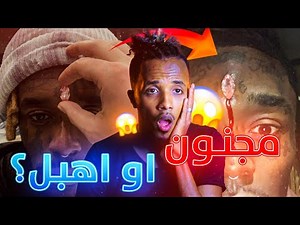 A crazy American singer planted diamonds on his forehead 😱 And so was the result