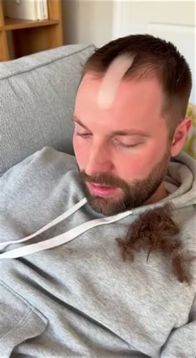Half-Bald Surprise! Toddler’s Haircut Prank Goes Viral 😂👶” #funny #hairstyle
