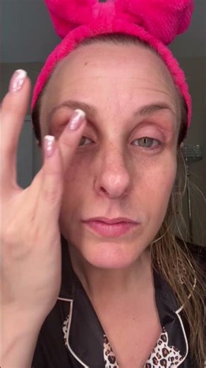 Fighting Wrinkles with Instatox