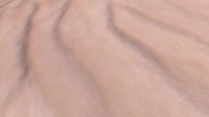 PRP with Microneedling (Patient Experience)