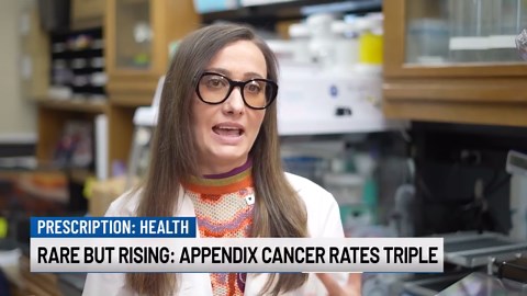 Rare But Rising: Appendix Cancer Rates Triple