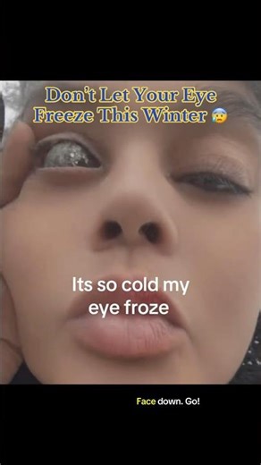 Don’t Let Your Eye Freeze This Winter 😰 #interesting