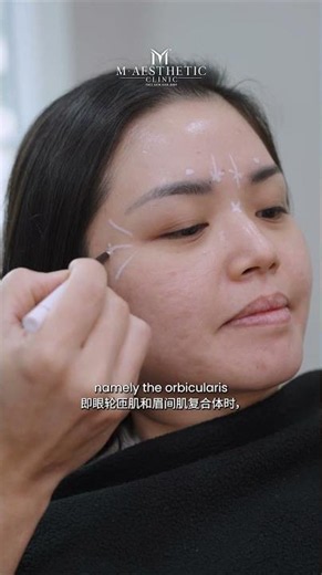 How to address droopy eyelids?