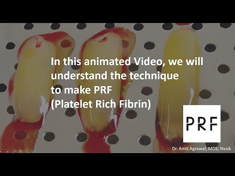 How to make PRF, Animated video