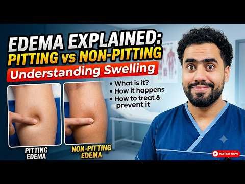 Edema Explained: Pitting vs Non-Pitting (How to Stop the Swelling)
