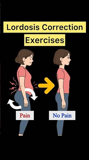 Correct Lordosis. Hyperlordosis Fix Exercise. #lowbackpain #spondylolisthesis #imbalance