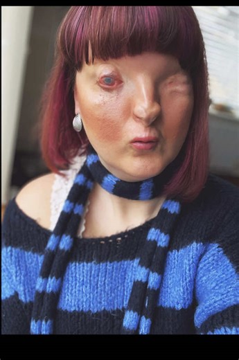 Busting Myths About Blindness and Literacy