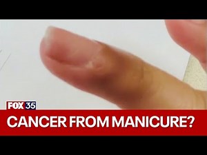 Doctor says manicure gave woman cancer under her fingernail