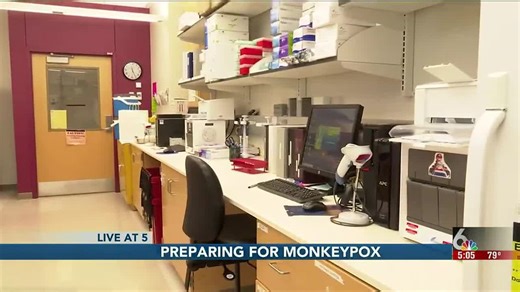 Nebraska’s Public Health Lab on alert for monkeypox