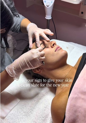 Start the new year with a facial 💕 The step you’re seeing is called dermaplaning 🤗 We use a gentle blade to remove vellus hair and dried dead skin cells. This leaves the skin “baby smooth” and allows for deeper penetration of home products. ✨ And yes, dermaplaning is included in our facial, no add ons here! Book with us today 🥰 Thank you @Olivia Faye for the amazing content! 💕 #theonlyfacial #beautifulskinmadesimple #dermaplane #satisfying #dermaplanebenefits
