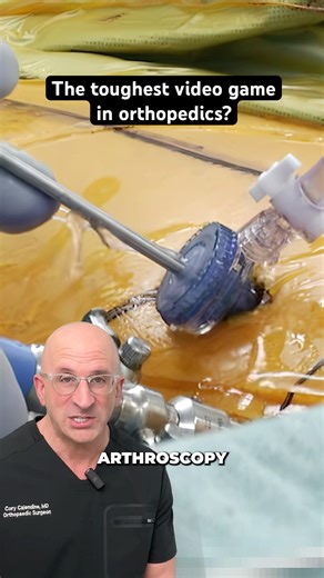 This Hip Surgery is Basically a Video Game on Hard Mode #surgery #skills