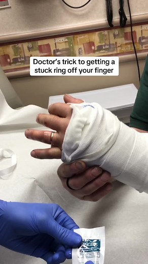 How to Remove a Stuck Ring from Your Finger