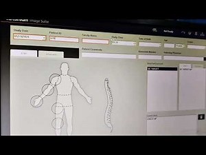 How medical imaging software works, Radiology setup demo...