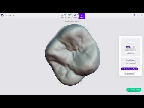 Circle One | Crown Workflow — Dexis & SprintRay