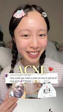 #MilkyDewAcademy 📓 How to ERASE acne✨ DIY TIP + using ‪@arencia_official‬ Eraser Shot Glycolic Acid✨