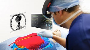 3D surgery using the eyes of a VR Hololens | 3D surgery using the eyes of a VR Hololens