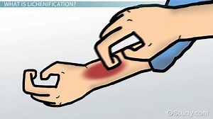 You must c C reate an account to continue watching