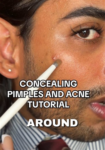 How to Effectively Cover Up Pimples with Makeup