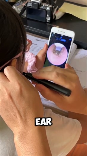 #ear cleaner camera