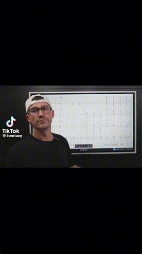 27K views · 474 reactions | 12 Lead ECG Basics from Ben! #paramedicstudent #emtstudent #emtschool #emt #emtlife #paramedic #paramedicschool #paramedicos #paramediclife #paramedicscience #paramedical | Master Your Medics | Facebook