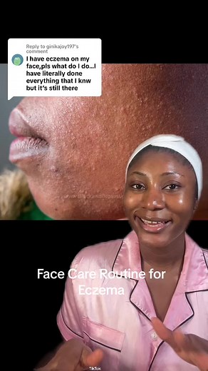 Face Care Routine for Eczema: Tips and Recommendations