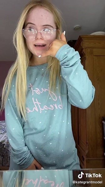 Inspirational Down Syndrome Transformations | Taylor Swift #Trending