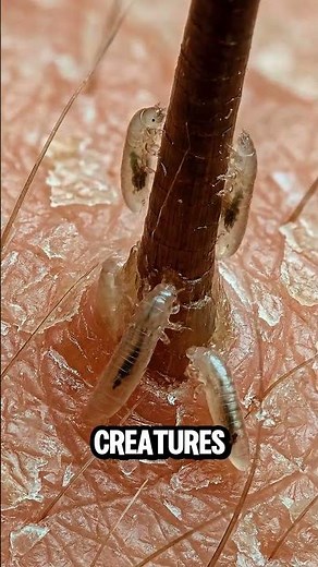 Living inside your pores... Right Now.