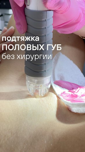 Проблема, с которой сталкиваются многие женщины 👇 Со временем или после родов кожа интимных мест может потерять свою эластичность и тонус. Это приводит к дряблости, снижению чувствительности и дискомфорту Такие изменения — это естественный процесс, но важно понимать, что такие изменения можно исправить. Уже сотни наших клиентов решили свои проблемы с помощью RF-Лифтинга — Процедура неинвазивная и не требует длительного восстановления — Уже после нескольких сеансов вы почувствуете улучшения — Ми