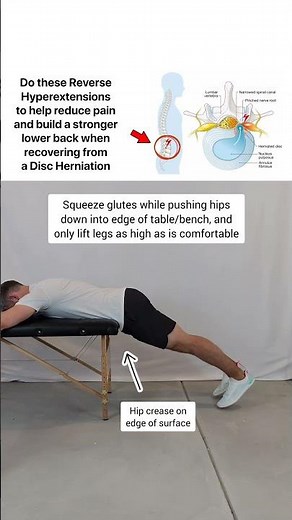 Disc Herniation - One of the Best Exercises to Help!