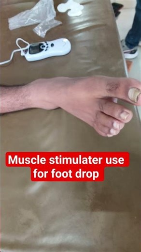 MS for foot drop #trending #motivation #physiohub #alternativemedicine #physiotherapy