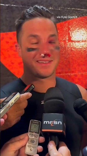 James McCann spoke after being hit in the face by a pitch #shorts
