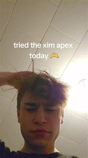 #whynutbut #rust #rustgame #rusttok #rustconsole #rustclips #rustgameplay #whynutbut #xim #zen #cronus