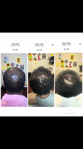 Strandzhairgro Mo Hair: A Creative Journey