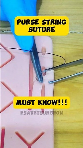 Must Know!!!. How to do purse string suture